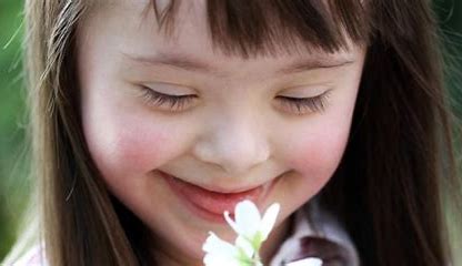 Mes de Concientización del Síndrome de Down Parque del Bicentenario