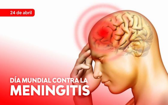 Los síntomas de la meningitis pueden confundirse con los de otras enfermedades
