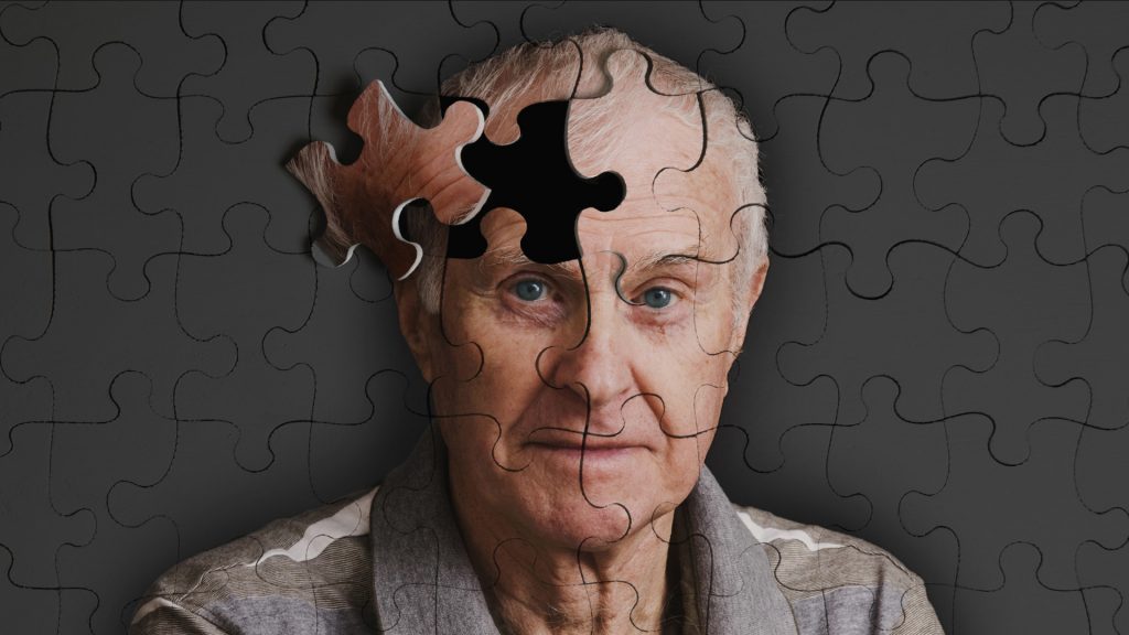 Claves para prevenir la enfermedad de Alzheimer, según los expertos