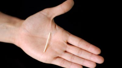 Jornada de implantes subdérmicos en la USI