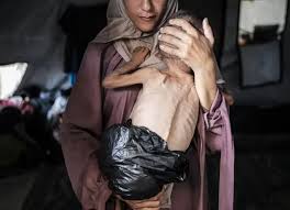 La historia de la foto de Hedaya y su bebé, una de las imágenes más impactantes de la hambruna en Gaza