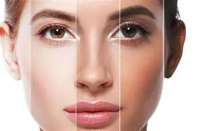 Hito médico: crean piel a partir de células del propio paciente