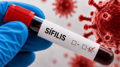 Preocupa en Salta el aumento de casos de sífilis